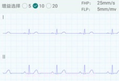 及时心电v1.1.18截图