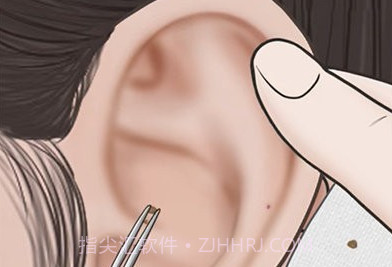 挖耳朵清洁模拟游戏v2.12截图