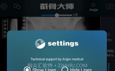截骨大师V1.12截图