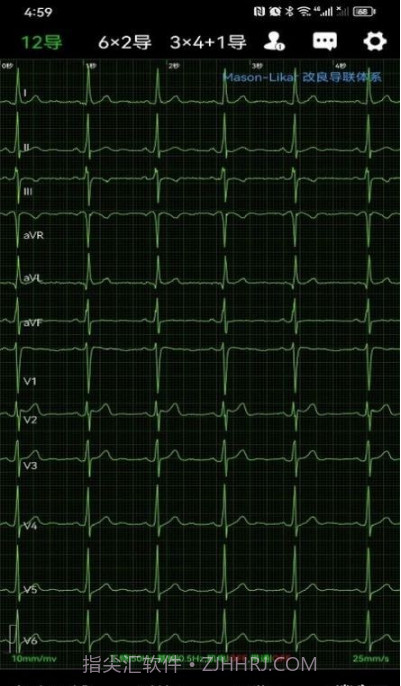 心电一张网截图4