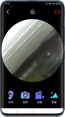 可视采耳仪截图3 可视采耳仪截图3