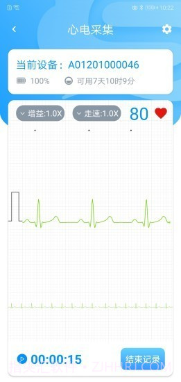 星康心电截图1 星康心电截图1