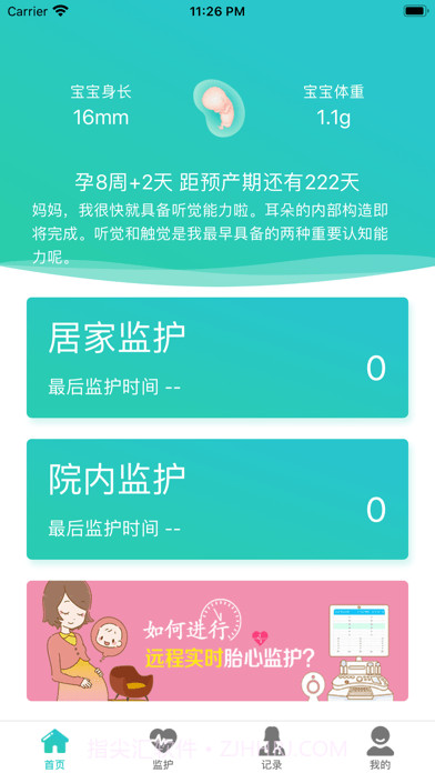 胎心监护截图1 胎心监护截图1