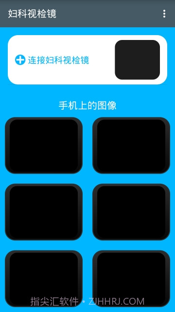 妇科视检镜截图1