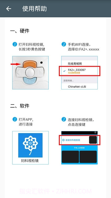 妇科视检镜截图2