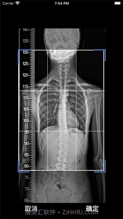 cobb角测量分析平台截图1