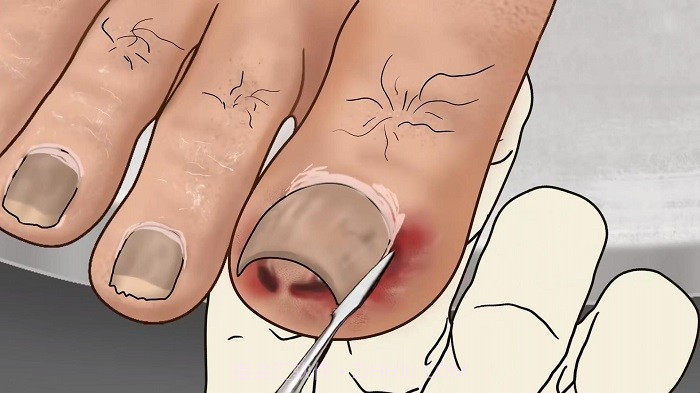 修脚足疔模拟器单机版截图1 修脚足疔模拟器单机版截图1