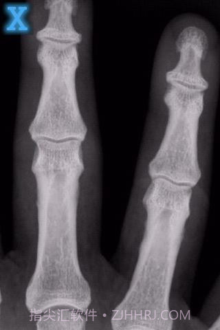 x光扫描器截图1