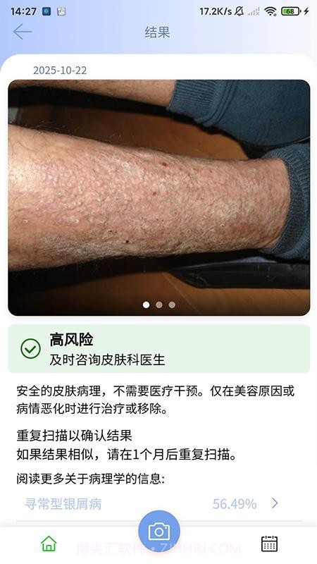 医用皮肤镜影像处理软件官网版截图4
